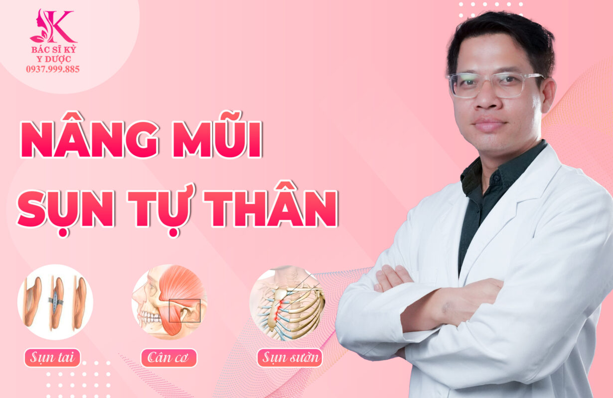 Nâng mũi sụn tự thân