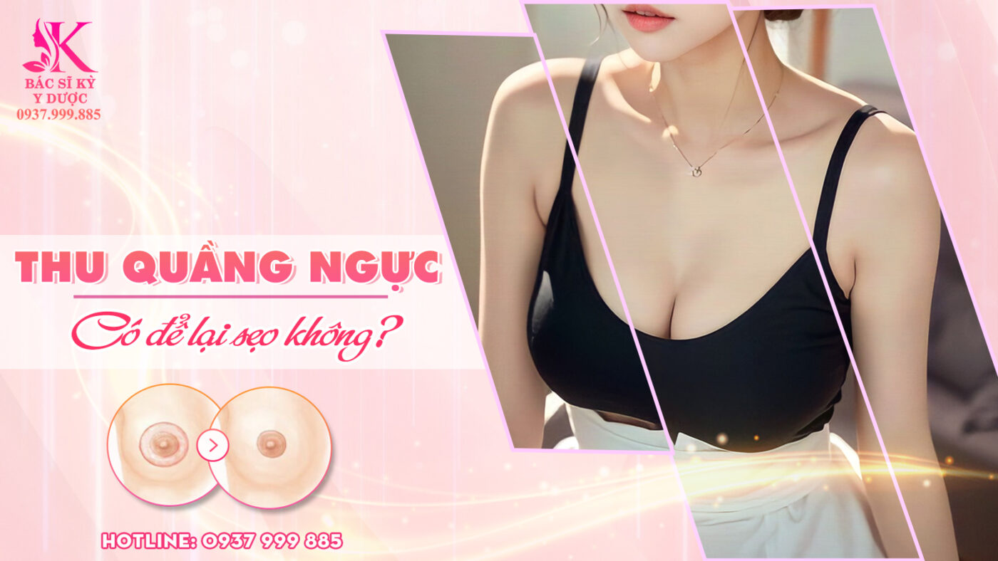 Thu quầng ngực có để lại sẹo không