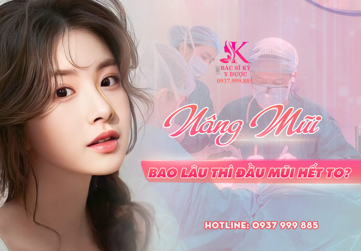 nâng mũi bao lâu thì đầu mũi hết to