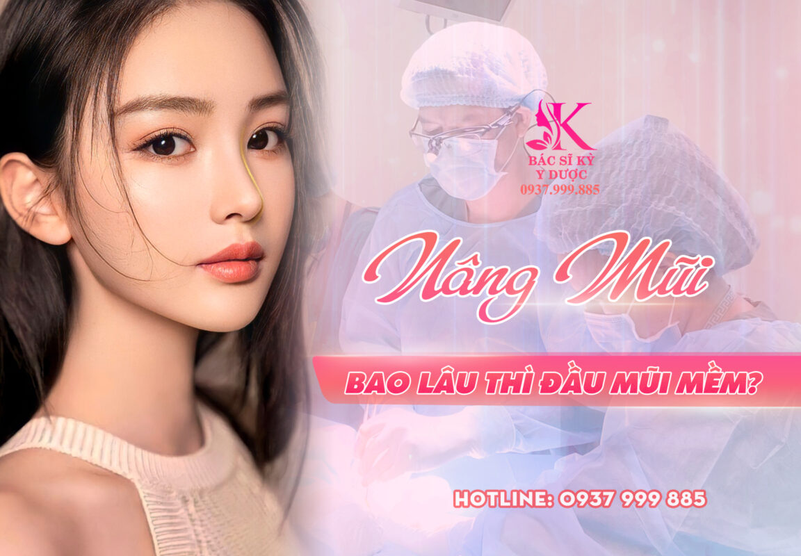 Nâng mũi bao lâu thì đầu mũi mềm