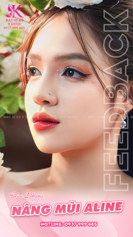 Nâng mũi cúi đầu được