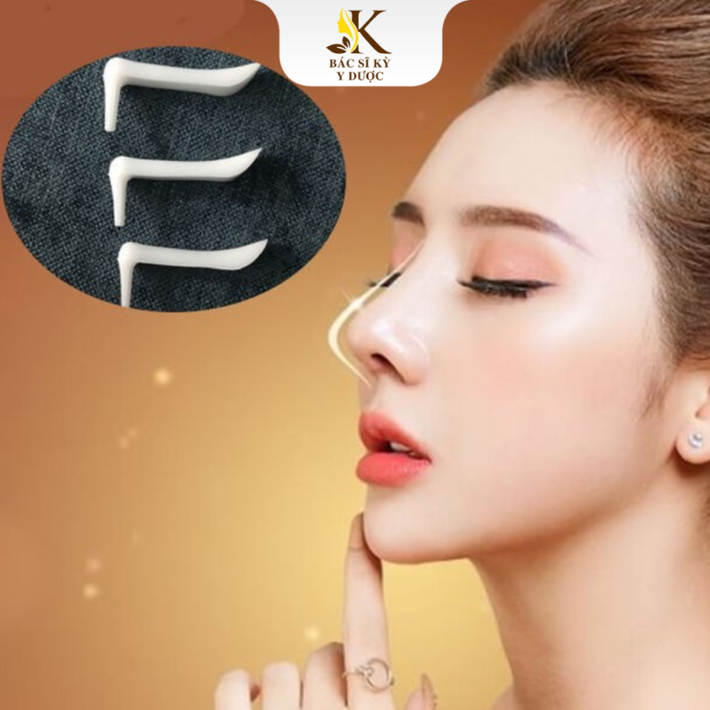 Nâng mũi sụn nhân tạo