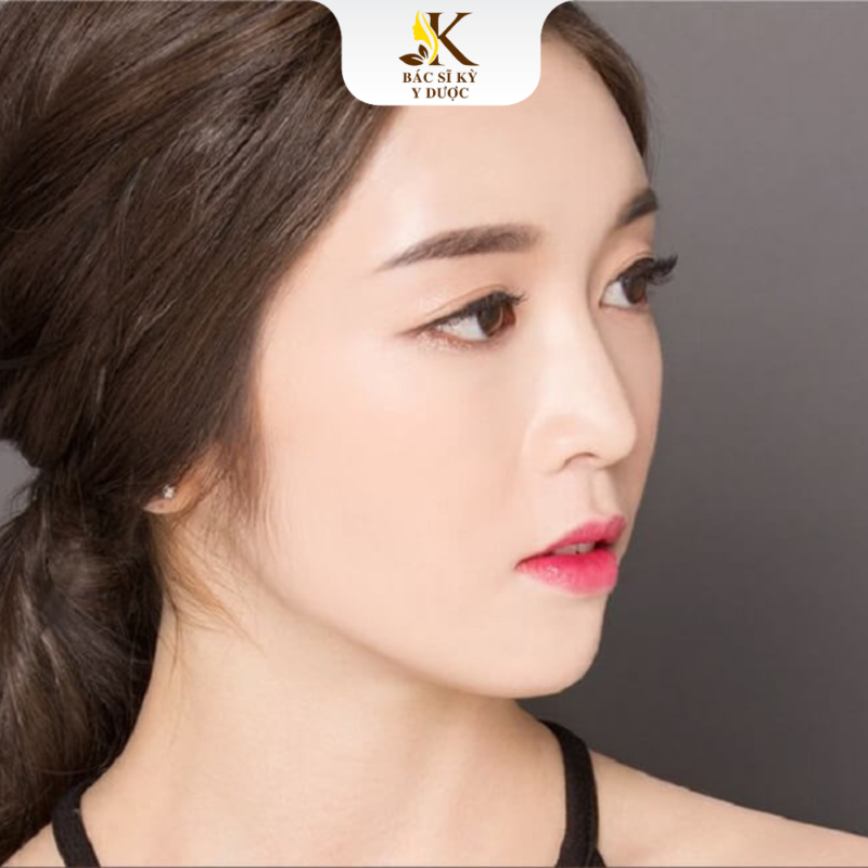 Nâng mũi hàn quốc