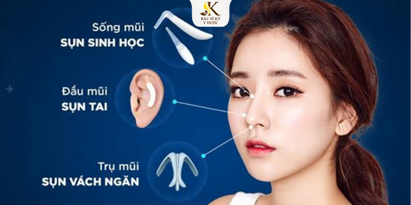 nâng mũi cấu trúc được bao lâu