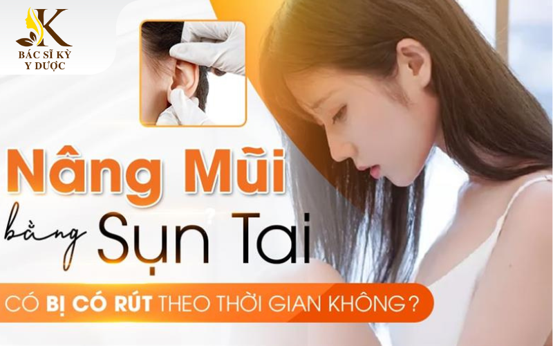 Nâng mũi bằng sụn tai có bị teo lại không