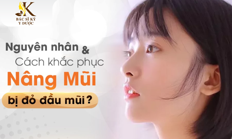 nâng mũi bị đỏ đầu mũi
