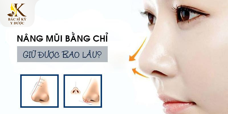 Những điều bạn cần biết về nâng mũi chỉ