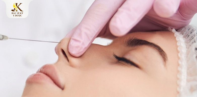 Có nên nâng mũi bằng chỉ hay không?