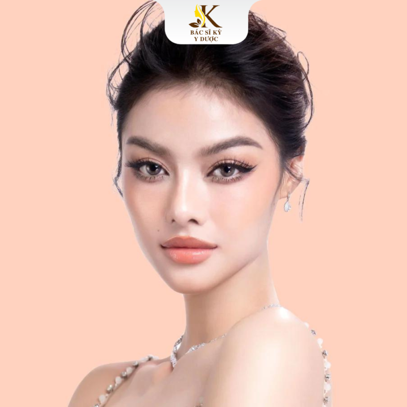 nâng mũi chỉ collagen giữ được bao lâu