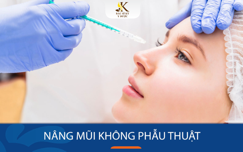 Nâng mũi không phẫu thuật