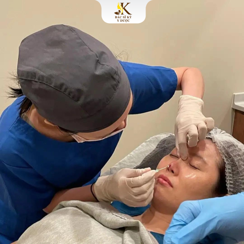 nâng mũi không phẫu thuật