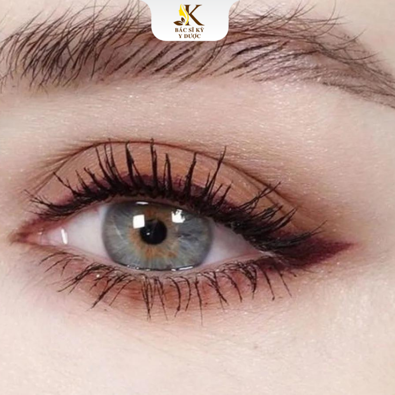 chỉnh sửa cắt mí hỏng