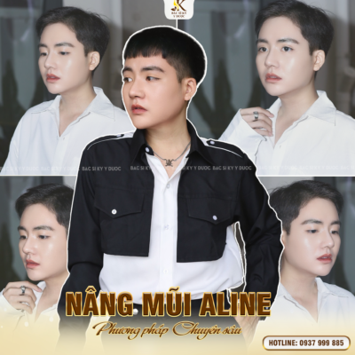 Nam giới có nên nâng mũi không? Nâng mũi ở đâu là đẹp nhất?