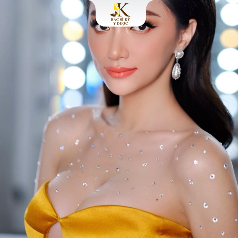 Nâng ngực cho người chuyển giới