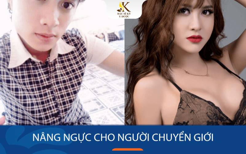 Nâng ngực cho người chuyển giới