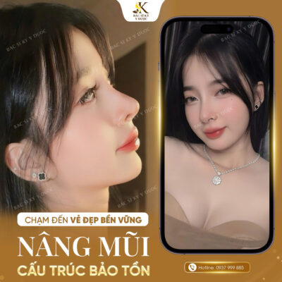 Khách hàng tự tin với dáng mũi đẹp chuẩn tỷ lệ vàng sau nâng mũi cấu trúc bảo tồn